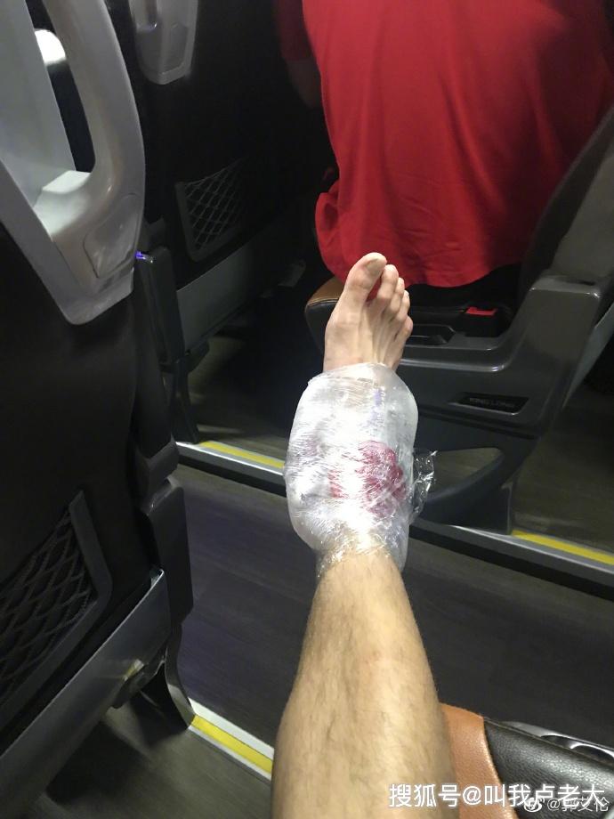郭艾伦在NBA夏季联赛晃倒了对手,昨晚他扭到了脚,严重吗?