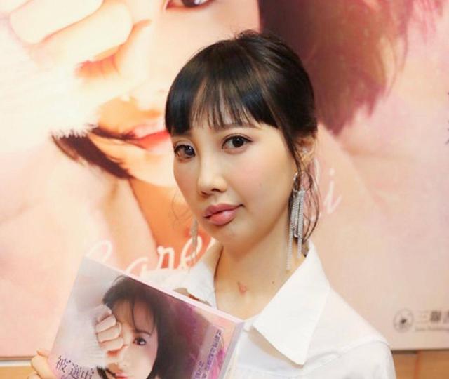 30岁香港女歌手积极抗癌7年 如今病情恶化导致面瘫仍未放弃梦想