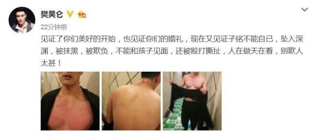 《庆余年》中最意外的演员,不誓静柱麒麟,而是曾深陷家暴风波的他