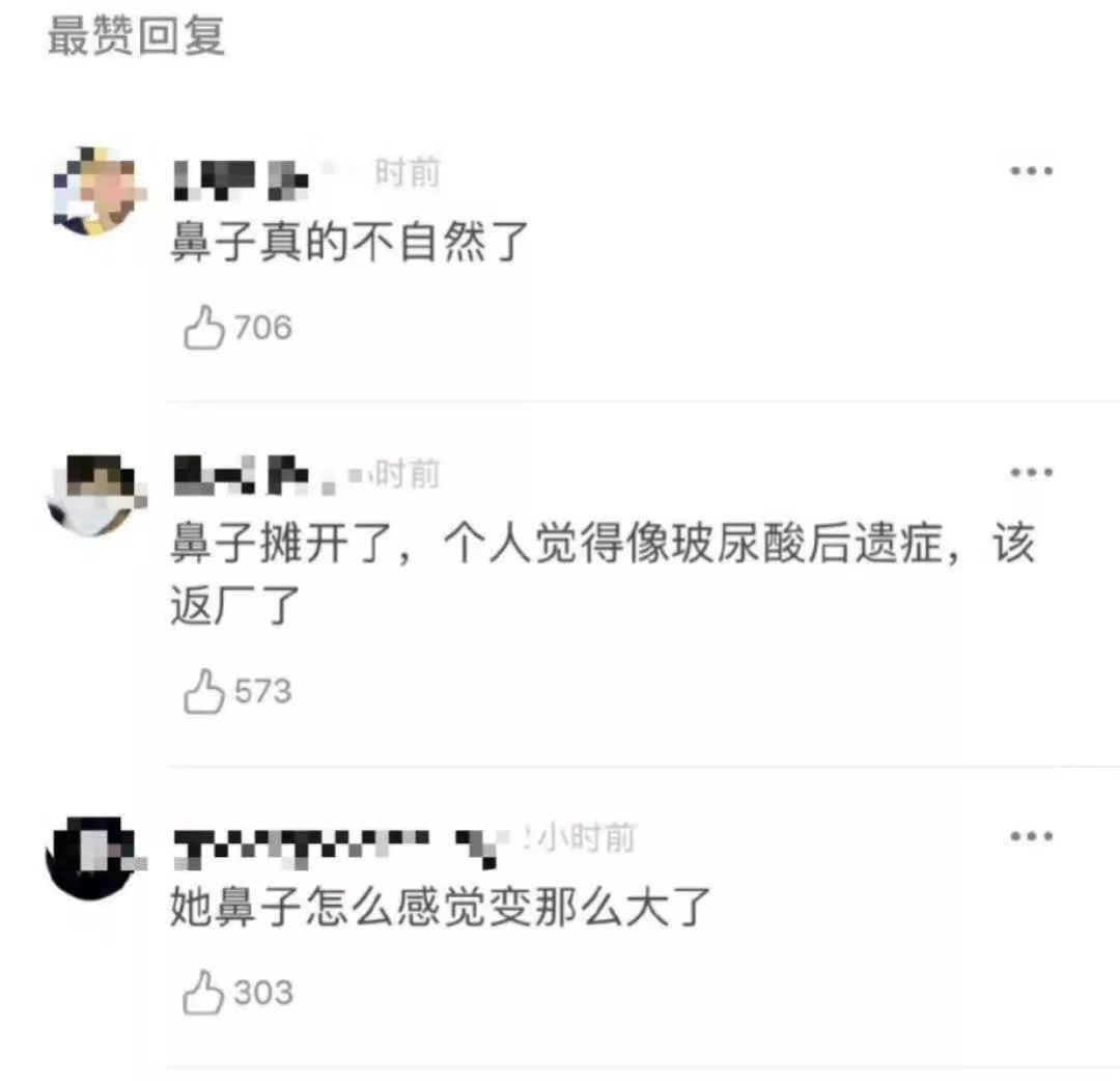 鞠婧祎《春晚》后又被质疑变脸,鼻子变大,网友嘲讽该返厂重修