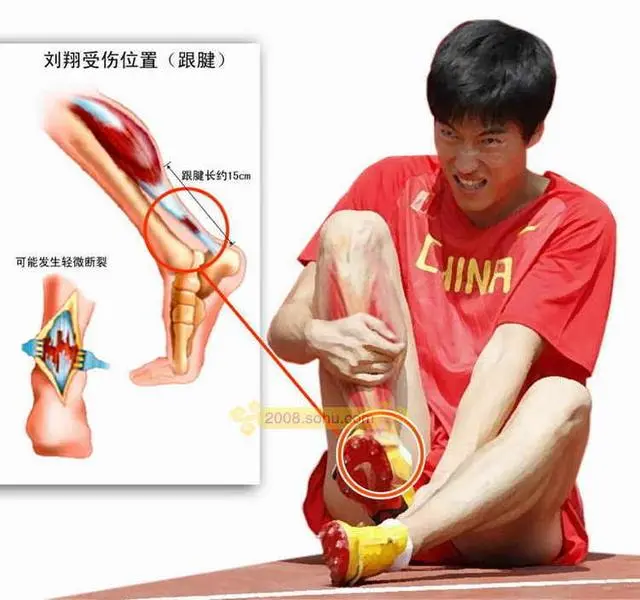 【生活】刘翔双腿估价1350万美元 没任何保险公司敢接招