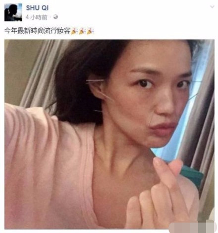舒淇自曝息影是为了治病,曾为治病想尽办法,甚至不洗澡