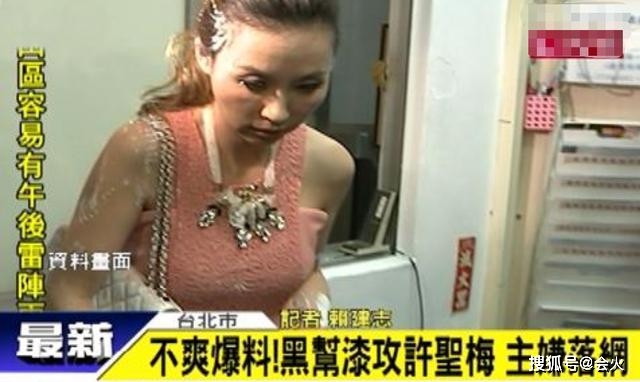 最惨女星!被丈夫逼迫拖病体还百万债务,28岁生子后病痛缠身30年