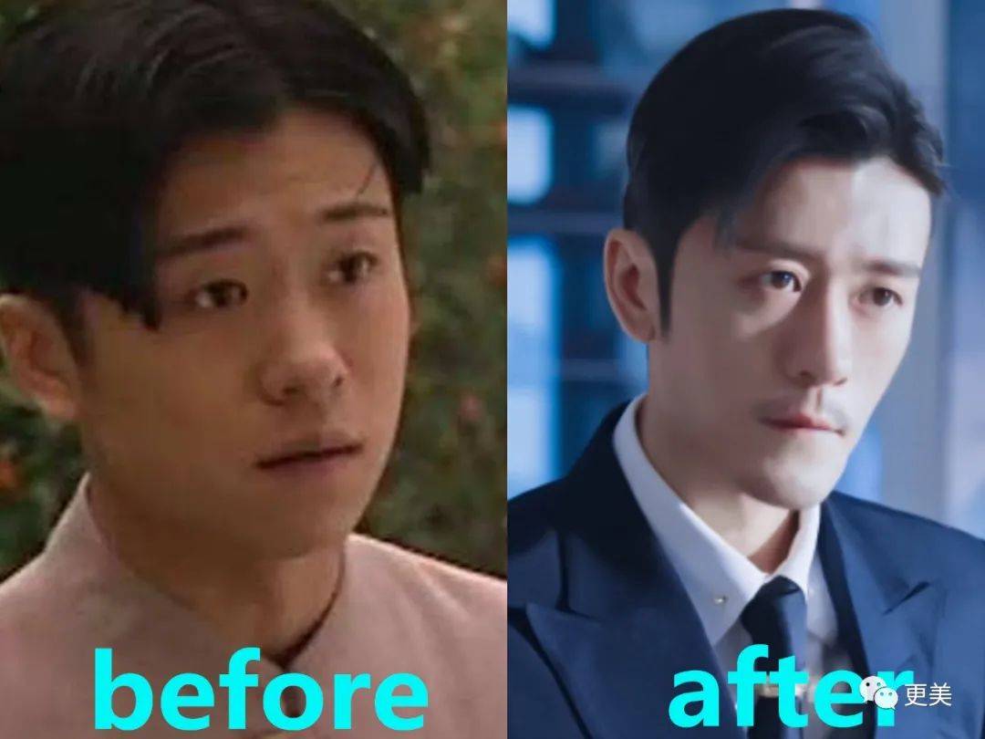贵圈首个do成锥子脸的男星,背靠资本压番顶流小生,真宝藏