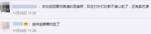 46岁林志玲撞脸萧蔷,苹果肌高耸脸颊圆润,手术后状态不佳?