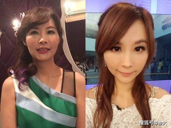 最惨女星!被丈夫逼迫拖病体还百万债务,28岁生子后病痛缠身30年