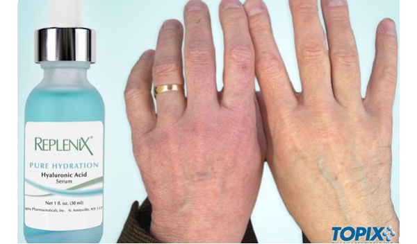 【43】 干燥细纹你走开,我有肌肤掐出水的小秘密