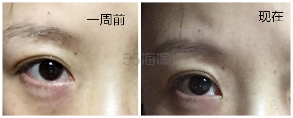 【转】Estee Lauder雅诗兰黛小棕瓶眼霜