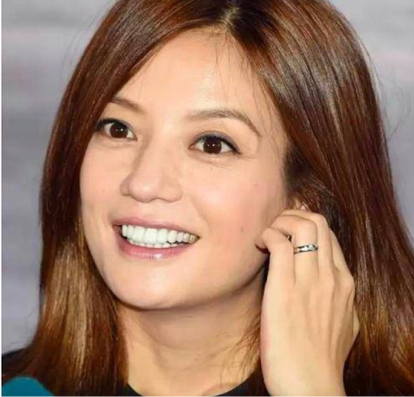 林允陈瑶脸型大变灵气全无,刘涛花300万找罪受,非要整一口假牙何必呢?