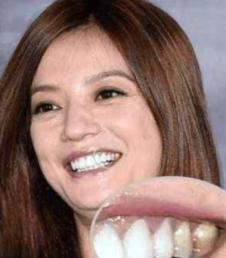 林允陈瑶脸型大变灵气全无,刘涛花300万找罪受,非要整一口假牙何必呢?