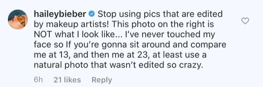 比伯妻子被指整容?!