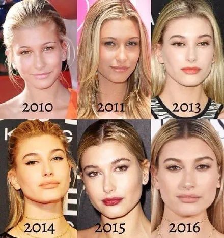 比伯妻子被指整容?!