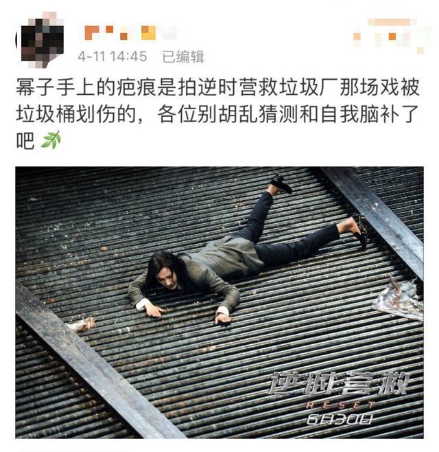 曝杨幂手上出现自残痕迹?粉丝澄清却受质疑,早年发言被扒引心疼