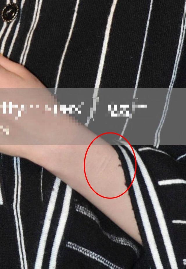 曝杨幂手上出现自残痕迹?粉丝澄清却受质疑,早年发言被扒引心疼