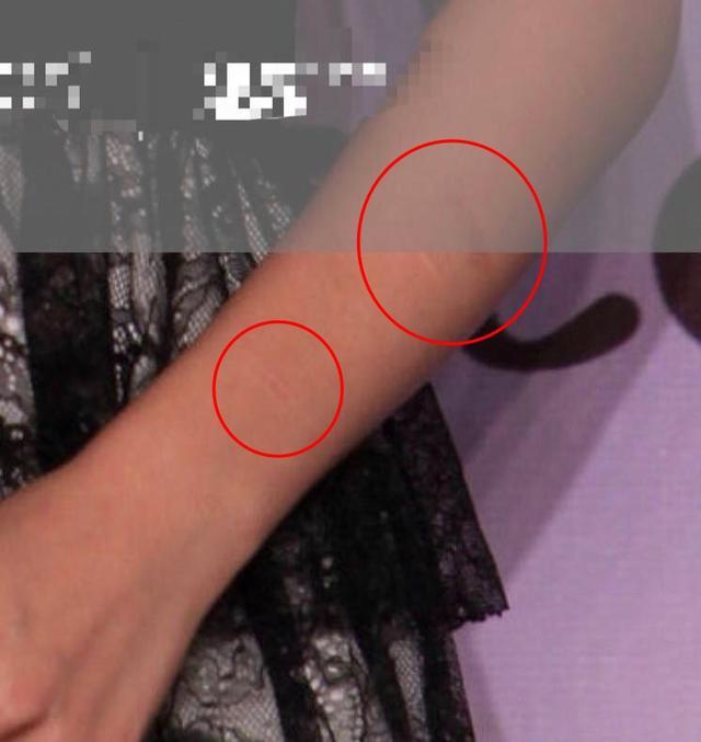 曝杨幂手上出现自残痕迹?粉丝澄清却受质疑,早年发言被扒引心疼