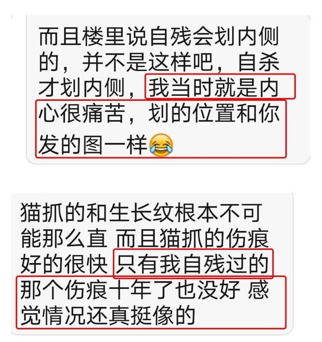 曝杨幂手上出现自残痕迹?粉丝澄清却受质疑,早年发言被扒引心疼