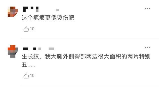 曝杨幂手上出现自残痕迹?粉丝澄清却受质疑,早年发言被扒引心疼