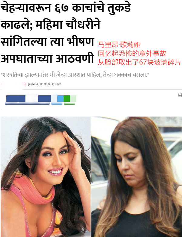 宝莱坞女演员自曝曾遭遇严重交通意外 脸部被扎进67块玻璃碎片