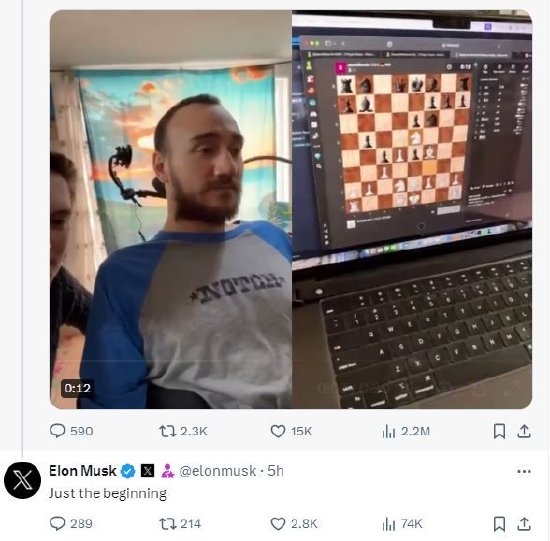 【萌猫】【转】脑机接口首位受试者用意念在X上发帖,马斯克回应