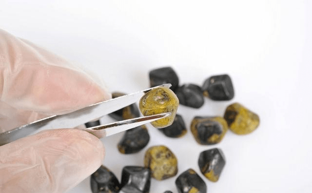 不吃早餐,真的会胆结石吗?