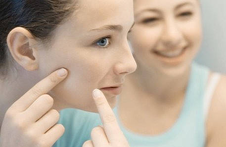 【时尚】【转】日常生活中去除脸上痘痘的小妙招和方法