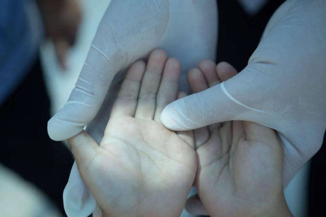 【萌喵】【转】成人也会感染手足口病?