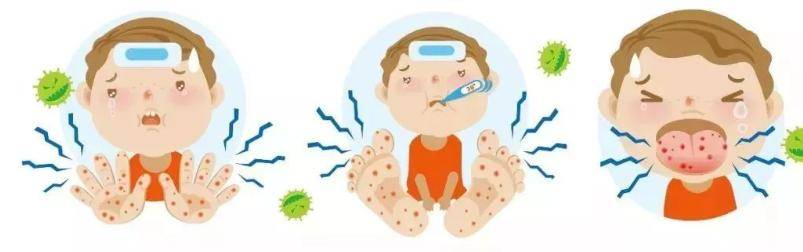 【时尚】【转】@家长们!暑期幼儿手足口病预防知识请查收