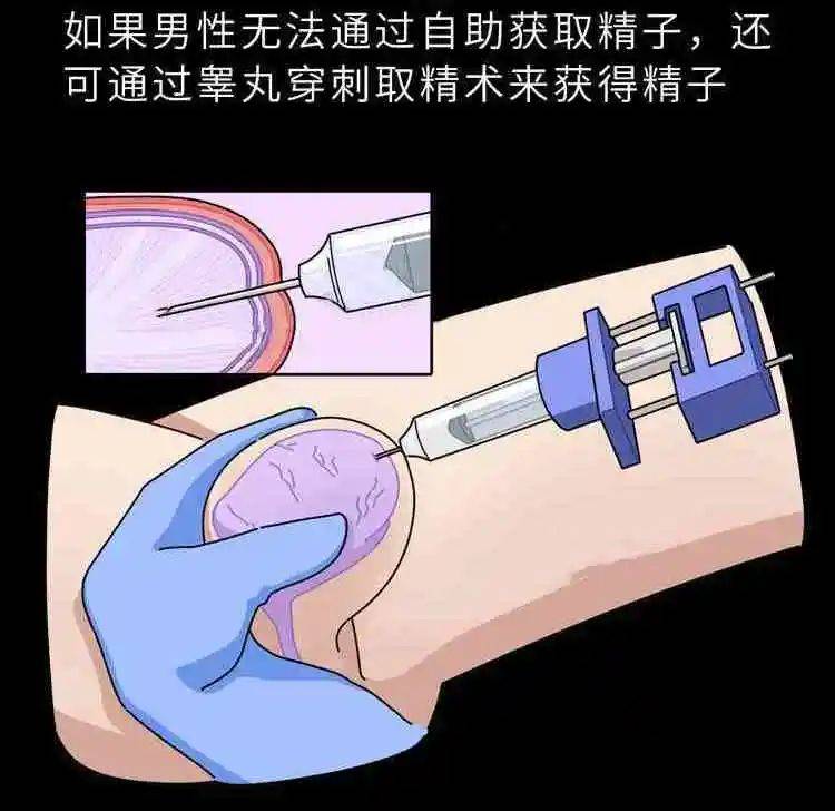 【花资】【转】不孕症要做哪些检查?了解这些接“好孕”