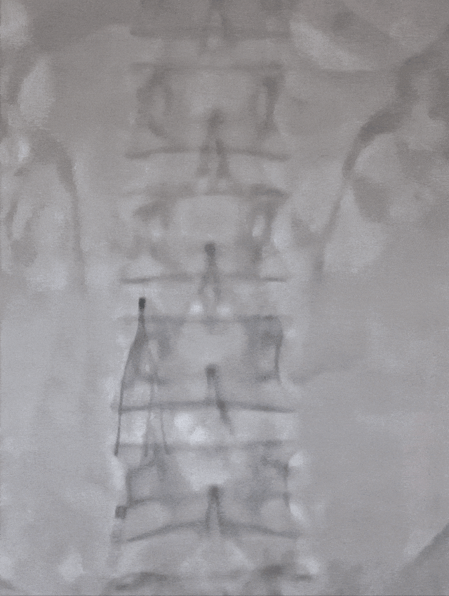 【萌喵】【转】狐大医 | 稍微一动就心慌?当心是“肺梗”了