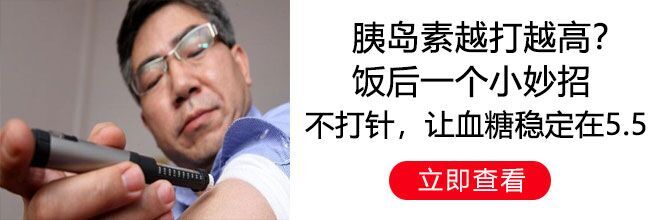 34比4!湖人输给雄鹿爆出致命隐患,詹姆斯超神发挥也无法夺冠了